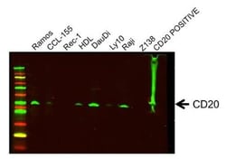 Novus Biologicals&trade;&nbsp;CD20 Overexpression Lysate